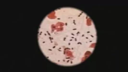 Image ER 1